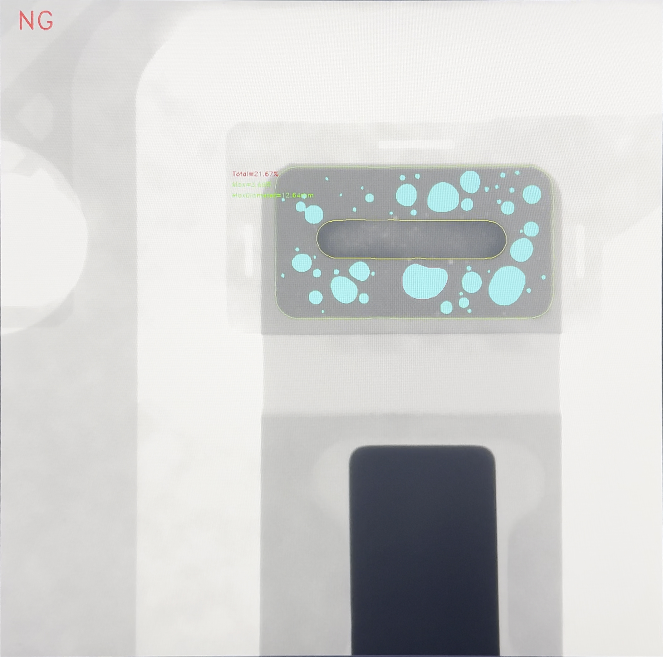 X射线检测FPC软板内部线路断路缺陷图谱-NG样本