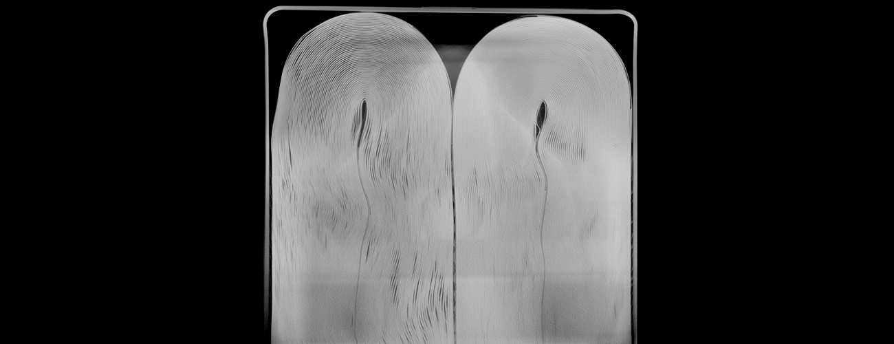 方形电池X射线检测图